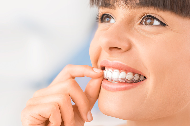 Orthodontics in Oxnard