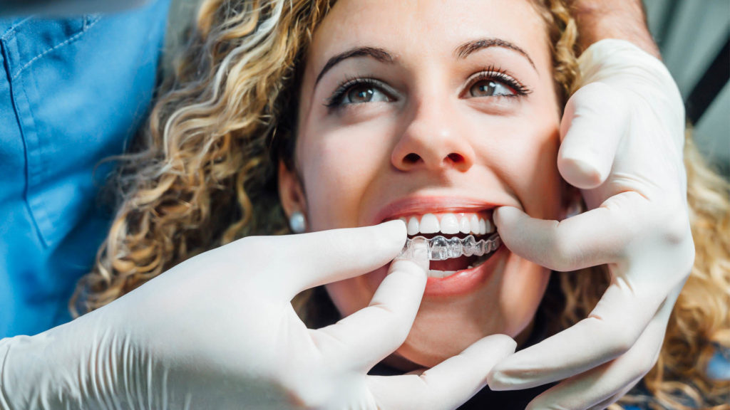 Doctor putting a clear Invisalign dental aligner in the patient's mouth.