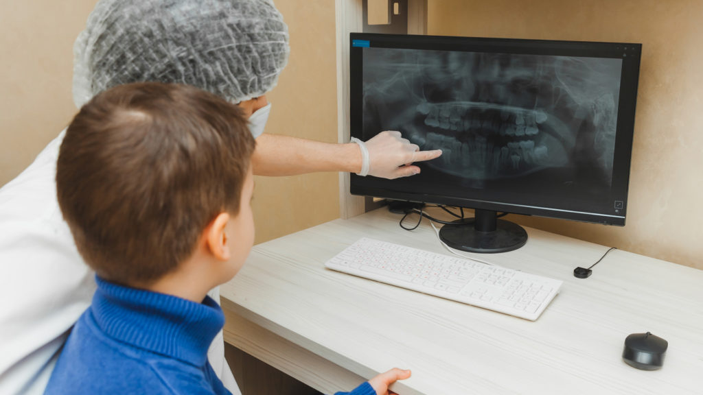 The dentist shows the x-ray of the teeth on the computer to the patient boy as they talk about back to school dental checkups
